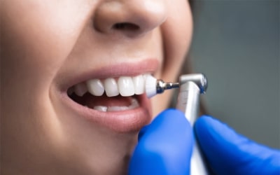 Dental Cleanings